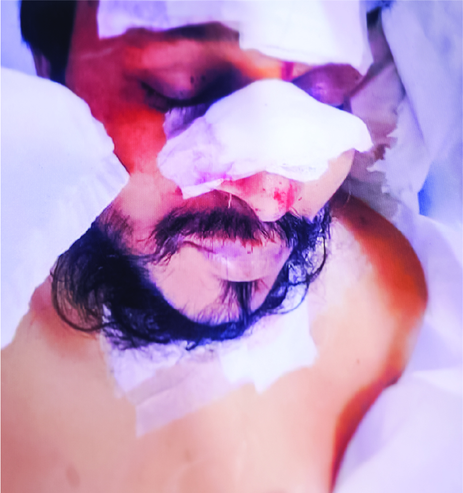 Image of মো: মামুন
